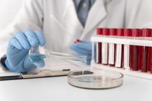 Анализ на наличие наркотиков