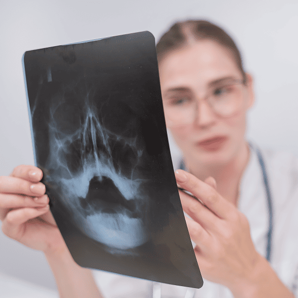 Рентген пазух носа