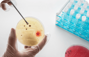 Анализ кала на дисбактериоз