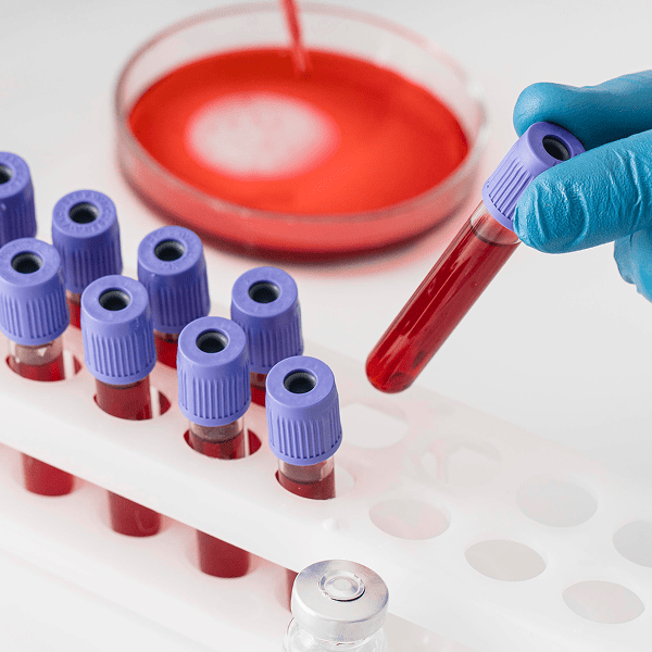 Биохимический анализ крови