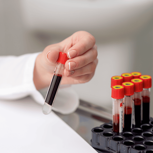 Анализ крови по форме 242/у