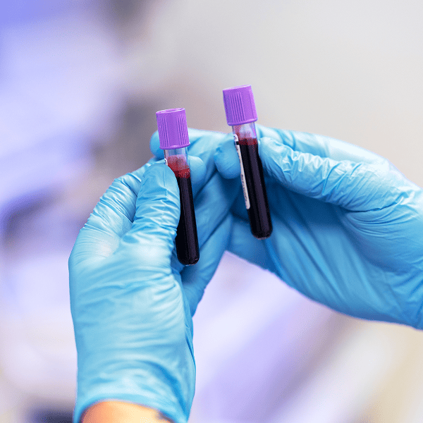 Анализ на содержание медиаторов и гормонов 235/у