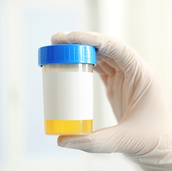 Анализ мочи по форме 214/у