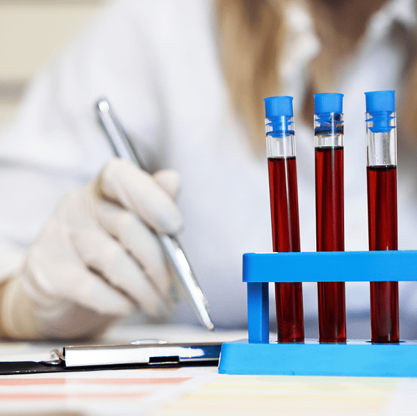 Анализ крови реакция Видаля